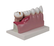 Dentalmodell, 4-fache Größe