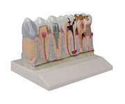 Dentalmodell, 4-fache Größe